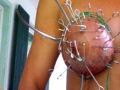 Very painful pricking